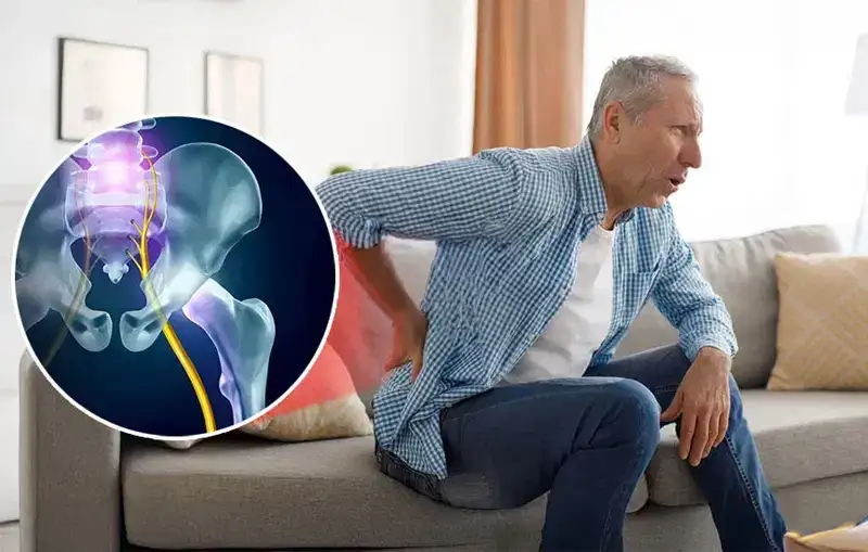 Illustration of the sciatic nerve pathway and a person experiencing lower back and leg pain